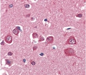 IHC analysis of FFPE human brain cortex tissue stained with PINK1 antibody