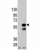 Western blot analysis of PINK antibody and 293 cell lysate (2 ug/lane) either nontransfected (Lane 1) or transiently transfected with the PINK gene (2) (1:2000)