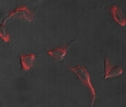 Immunofluorescence analysis of Nestin antibody and HeLa cells. Primary antibody was followed by Alexa-Fluor-546-conjugated donkey anti-rabbit lgG (H+L). Alexa-Fluor-546 emits orange fluorescence.