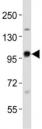 Western blot testing of EZH2 antibody at 1:1000 dilution + rat C6 lysate; Predicted size : 85-95 kDa.