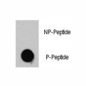 Dot blot analysis of phospho-TSC2 antibody. 50ng of phos-peptide or nonphos-peptide per dot were spotted.