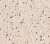 IHC staining of FFPE human brain tissue with MLL2 antibody. HIER: steam section in pH9 EDTA for 20 min and allow to cool prior to staining.
