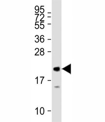 MML2 antibody tested on human recombinant protein at 1:27000.