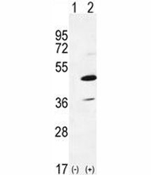 Western blot analysis of IRAK4 antibody and 293 cell lysate either nontransfected (Lane 1) or transiently transfected (2) with the IRAK4 gene. Predicted molecular weight 52/37 kDa (isoforms 1/2).~