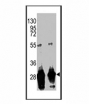 Western blot analysis of anti-GFP antibody and recombinant protein.