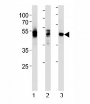 LCK antibody western blot analysis in 1) HL-60, 2) Jurkat and 3) NCI-H292 lysate. Predicted molecular weight ~58 kDa.