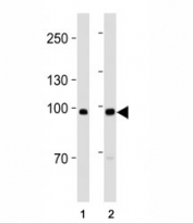 ACE2 antibody western blot analysis in MDA-MB-453, MCF-7 lysate. Predicted molecular weight: 90-100 kDa.