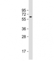 Western blot testing of MCF7 cell lysate with YES1 antibody at 1:4000. Predicted molecular weight: 61 kDa.