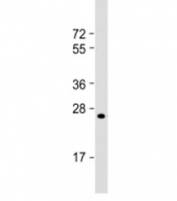 Western blot testing of human A431 cell lysate with RAB5B antibody at 1:2000. Predicted molecular weight: 24 kDa.