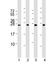 Western blot testing of human 1) HeLa, 2) HepG2, 3) Jurkat and 4) mouse NIH3T3 cell lysate with RAB5B antibody at 1:2000. Predicted molecular weight: 24 kDa.~