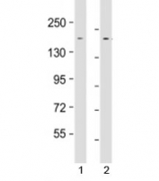 Western blot testing of human 1) HeLa and 2) HepG2 cell lysate with LAP2 antibody at 1:1000. Predicted molecular weight: 158 kDa.