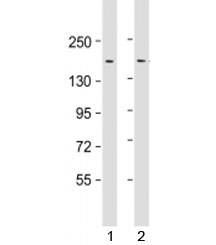 Western blot testing of human 1) HeLa and 2) SW480 cell lysate with LAP2 antibody at 1:1000. Predicted molecular weight: 158 kDa.~