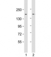 Western blot testing of human 1) HeLa and 2) SW480 cell lysate with LAP2 antibody at 1:1000. Predicted molecular weight: 158 kDa.