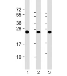 Western blot testing of human 1) A431, 2) HL-60 and 3) U2OS cell lysate with RAB5C antibody at 1:2000. Predicted molecular weight: 23 kDa.~
