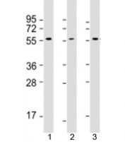 Western blot testing of 1) human MCF7, 2) human Jurkat and 3) rat PC-12 cell lysate with AKT2 antibody at 1:2000. Predicted molecular weight: 56 kDa.