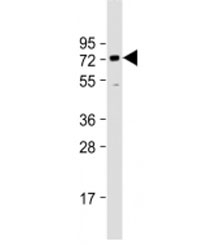 Western blot testing of human HeLa cell lysate with BANP antibody at 1:1000. Predicted molecular weight: 56 kDa, observed here at ~70 kDa.~