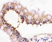 IHC testing of FFPE human colon with E-Cadherin antibody at 1:25. HIER: steamed in pH6 citrate buffer.