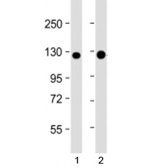 Western blot testing of human 1) A431 and 2) T47D cell lysate with E-Cadherin antibody at 1:4000. Expected molecular weight: ~135 kDa (precursor), 80-120 kDa (mature, depending on gylcosylation level).~