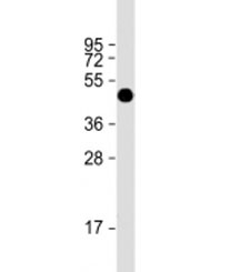 Western blot testing of human recombinant protein with FAT1 antibody at 1:2000.