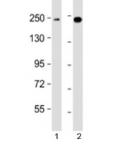 Western blot testing of human 1) K562 and 2) MCF7 cell lysate with XRN1 antibody at 1:2000. Predicted molecular weight: 194 kDa.