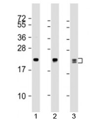 Western blot testing of human 1) MCF7, 2) A431 and 3) A549 cell lysate with RAB13 ant