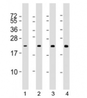 Western blot testing of human 1) MCF7, 2) A431, 3) A549 and 4) U87 MG cell lysate with RAB13 antibody at 1:1000. Predicted molecular weight: 23 kDa.