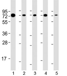 Western blot testing of human 1) Raji, 2) HeLa, 3) Daudi, 4) HT-29 and 5) mouse NIH3T3 cell lysate with SAM68 antibody at 1:2000. Predicted molecular weight 48 kDa but routinely observed at 62-68 kDa.~
