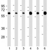 Western blot testing of 1) human HeLa, 2) human Jurkat, 3) human HepG2, 4) human liver, 5) mouse brain and 6) mouse heart lysate with PGM1 antibody at 1:2000. Predicted molecular weight: 61 kDa.