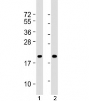 Western blot testing of human 1) NCI-H460 and 2) DU-145 cell lysate with IDNK antibody at 1:8000. Predicted molecular weight: 21 kDa.