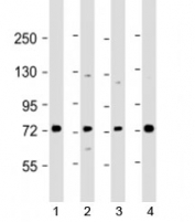 Western blot testing of human 1) Raji, 2) A549, 3) HL-60 and 4) K562 cell lysate with SKI antibody at 1:2000. Predicted molecular weight: 80 kDa.
