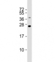 Western blot testing of human liver lysate with TMED4 antibody at 1:2000. Predicted molecular weight: 26 kDa.