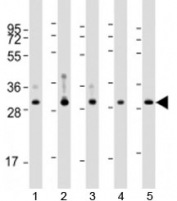 Western blot testing of human 1) MCF-7, 2) liver, 3) lung, 4) placenta and 5) kidney lysate with WBP1 antibody at 1:4000. Predicted molecular weight: 29 kDa.