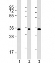 Western blot testing of human 1) K562, 2) THP-1, and 3) HT-1080 cell lysate with TMEM158 antibody at 1:2000. Expected molecular weight: 30-40 kDa.