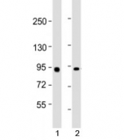 Western blot testing of human 1) Raji and 2) HeLa cell lysate with MYBL2 antibody at 1:2000. Predicted molecular weight: ~79 kDa, may also be observed at 100~110 kDa.