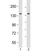 Western blot testing of human 1) Jurkat and 2) K562 cell lysate with TACC3 antibody at 1:2000. Expected molecular weight: 90/140-150 kDa (unmodified, phosphorylated).