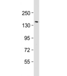 Western blot testing of human brain lysate with RTN4 antibody at 1:2000. Predicted molecular weight: 130 kDa.