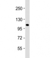 Western blot testing of mouse NIH3T3 cell lysate with GLI1 antibody at 1:2000. Expected molecular weight: 100~160 kDa.