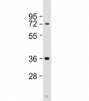 Western blot testing of human brain lysate with NMNAT1 antibody at 1:1000. Predicted molecular weight: 32 kDa.