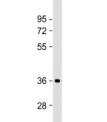 Western blot testing of human brain lysate with NMNAT1 antibody at 1:2000. Predicted molecular weight: 32 kDa.~