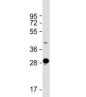 Western blot testing of human skeletal muscle lysate with DNASE1L2 antibody at 1:2000. Predicted molecular weight: 33 kDa.