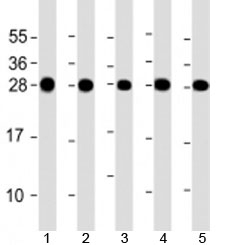 Western blot testing of human 1) HeLa, 2) Jurkat, 3) MCF-7, 4) U-2OS and 5) A431 cell lysate with RPL14 antibody at 1:2000. Predicted molecular weight: 23 kDa.~