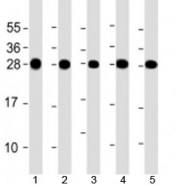 Western blot testing of human 1) HeLa, 2) Jurkat, 3) MCF-7, 4) U-2OS and 5) A431 cell lysate with RPL14 antibody at 1:2000. Predicted molecular weight: 23 kDa.