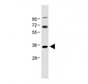 Western blot testing of human U-87 MG cell lysate with NAT8L antibody at 1:1000. Predicted molecular weight: ~33 kDa but can be observed from 35~45 kDa.
