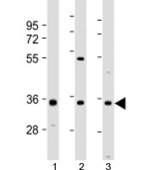 Western blot testing of 1) human 293T/17, 2) mouse brain and 3) human SH-SY5Y cell lysate with NAT8L antibody at 1:2000. Predicted molecular weight: ~33kDa but can be observed from 35~45kDa.