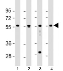 Western blot testing of human 1) fetal liver, 2) lung, 3) Jurkat and 4) K562 cell lysate with EFS antibody at 1:2000. Predicted molecular weight: 59 kDa.