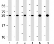 Western blot testing of human 1) HeLa, 2) Jurkat, 3) MCF-7, 4) 293T/17, 5) U-2OS and 6) A431 cell lysate with RPL14 antibody at 1:2000. Predicted molecular weight: 23 kDa.