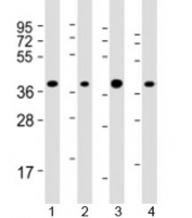 Western blot testing of human 1) HepG2, 2) Jurkat, 3) Li-7 and 4) RPMI-8226 cell lysate with ARHGEF39 antibody at 1:2000. Predicted molecular weight: 38 kDa.