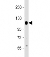 Western blot testing of human A549 cell lysate with PTPN12 antibody at 1:2000. Predicted molecular weight: 88 kDa, observed here at ~120 kDa.