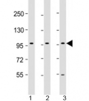Western blot testing of human 1) HepG2, 2) PC-3 and 3) U-87 MG cell lysate with PCDH10 antibody at 1:2000. Predicted molecular weight: 113 kDa.