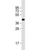 Western blot testing of human skeletal muscle lysate with TMEM115 antibody at 1:2000. Predicted molecular weight: 38 kDa.